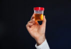 Urocultura: quando o exame ajuda a descobrir a causa da infecção urinária