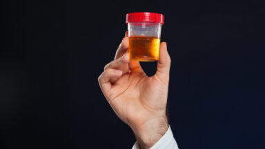 Urocultura: quando o exame ajuda a descobrir a causa da infecção urinária