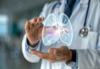 Câncer de pulmão: SUS terá três novos medicamentos