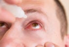 Olhos secos no ar-condicionado: quando é preciso se preocupar?