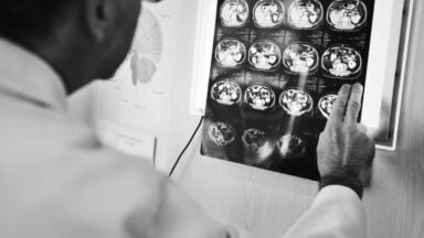 Endometriose cerebral? Pesquisas apontam possibilidades